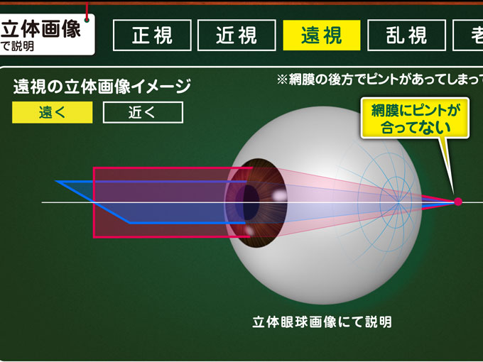 遠視スタッフの感想 メガネの複数所持（使い分け）の有り難みを実感しています | 滋賀県 大津の眼鏡・補聴器専門店 メガネのイマホリ